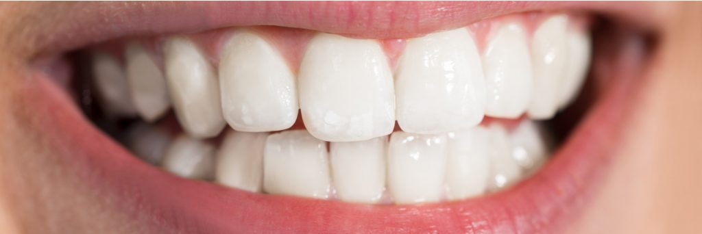 how-to-whiten-teeth